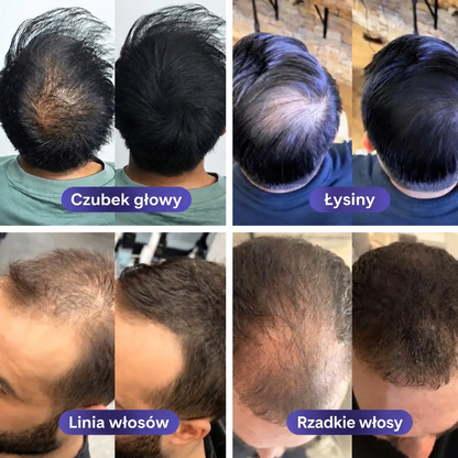 puder-swk-galeria-4-strefy