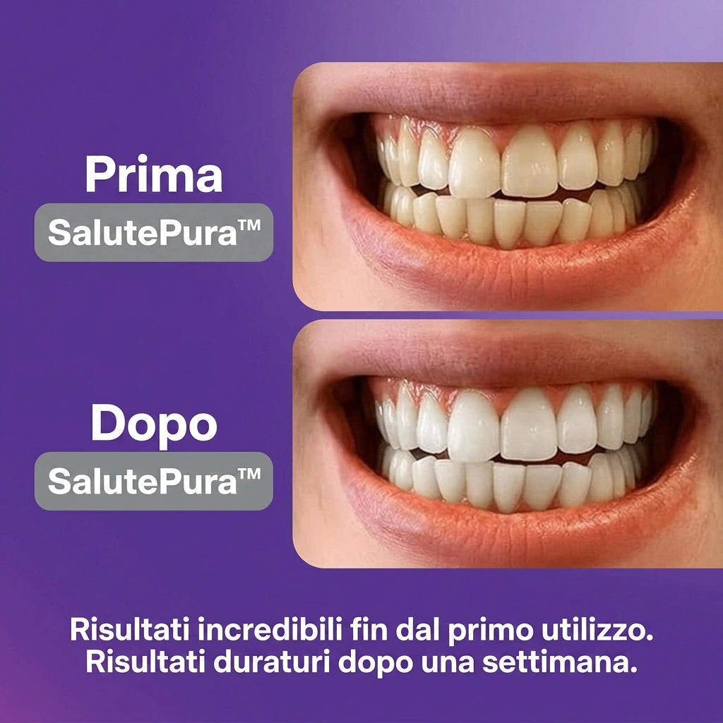 SalutePura™ - Strisce Sbiancanti