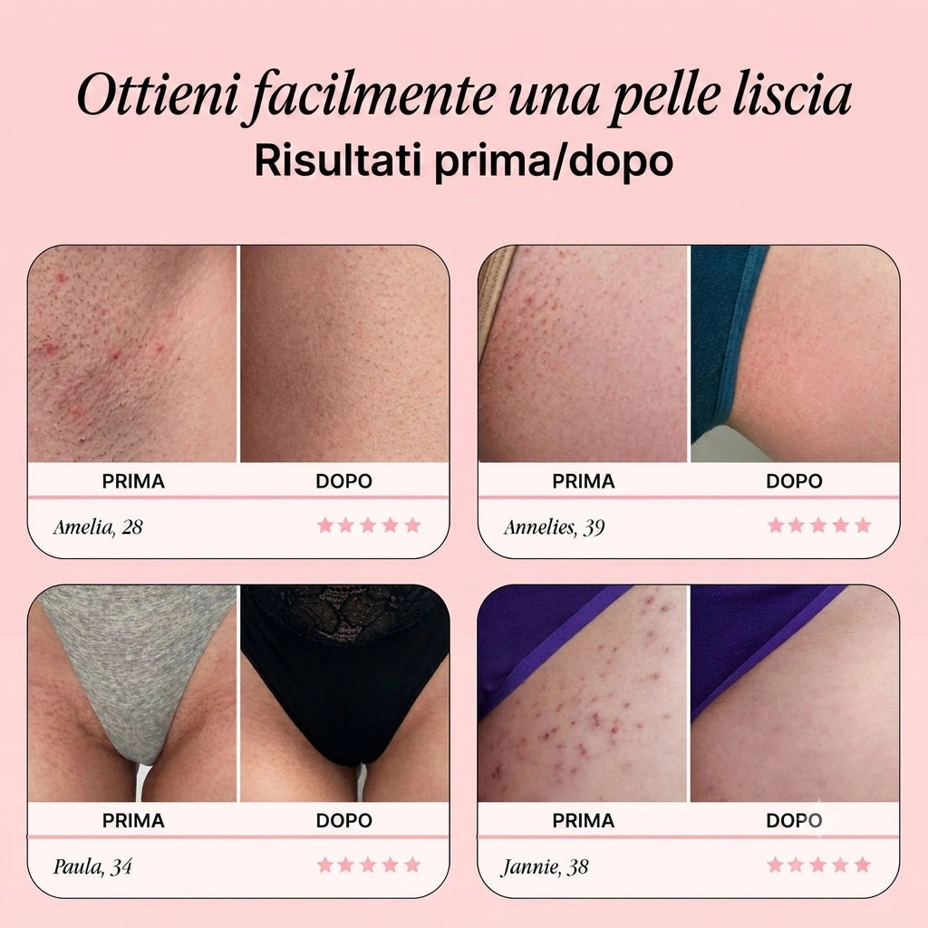 Rasoio originale – Ricevi 10 lame di ricambio GRATIS per un periodo limitato.