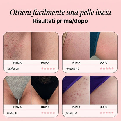 Rasoio originale – Ricevi 10 lame di ricambio GRATIS per un periodo limitato.