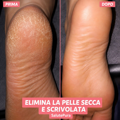 L'ORIGINALE - FootGlow™