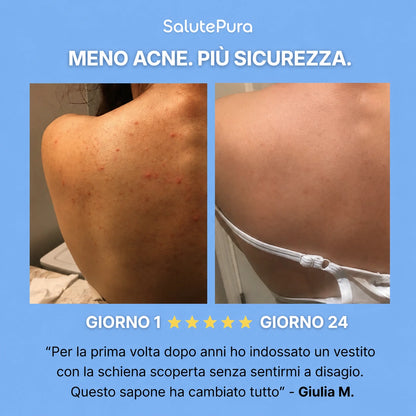 Sapone Purificante Anti-Acne™