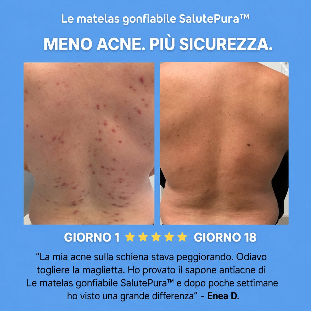 Sapone Purificante Anti-Acne™