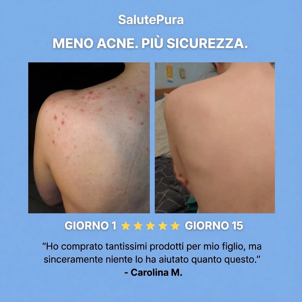 Sapone Purificante Anti-Acne™